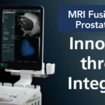 MRI Guided Prostate Biopsy