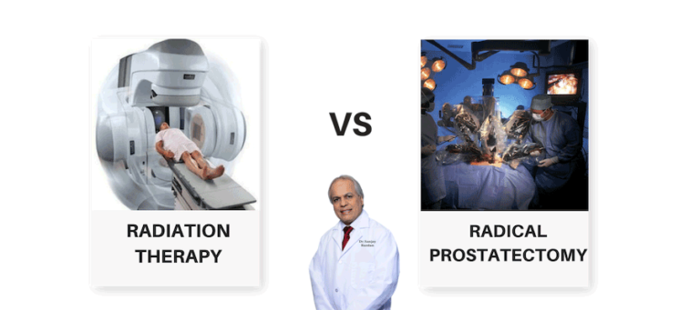Radiation Therapy Vs Prostatectomy Pelo Dr Razdan Melhor Urologista