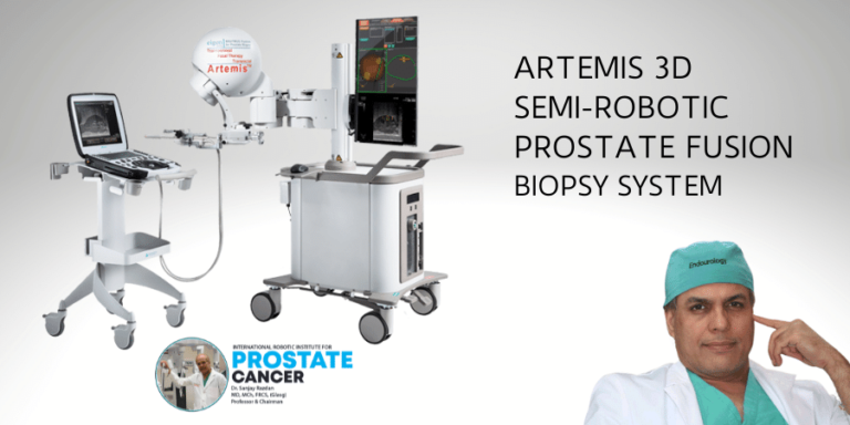 Prostate Fusion Biopsy By Dr Razdan Prostate Cancer Treatment