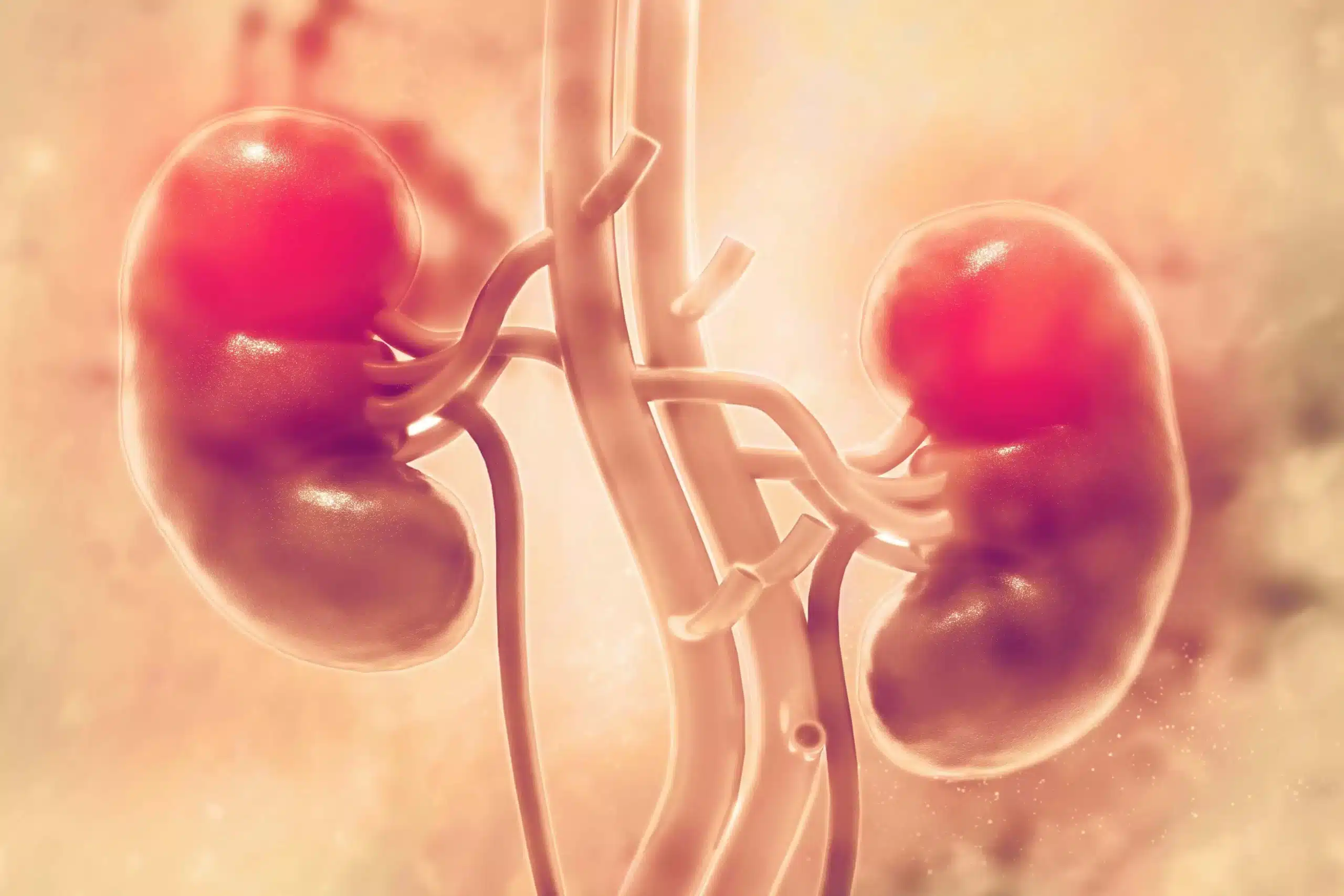 Latin America to Miami: Elite Care for High-Risk Prostate Cancer