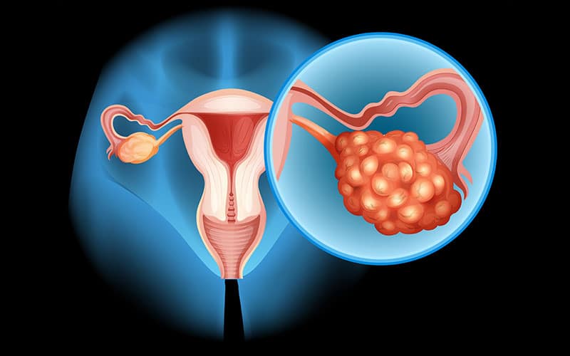 How Human Amniotic Membrane Accelerates Healing After Prostatectomy